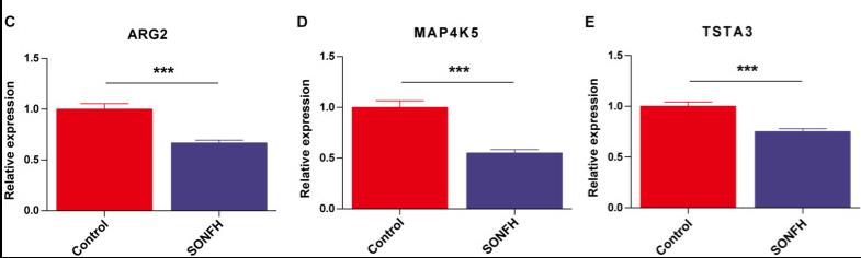 Validation of the expressions of potential diagnostic markers via qRT-PCR.jpg